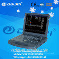 DW-C60 color Doppler embarazo escáner ultrasonido